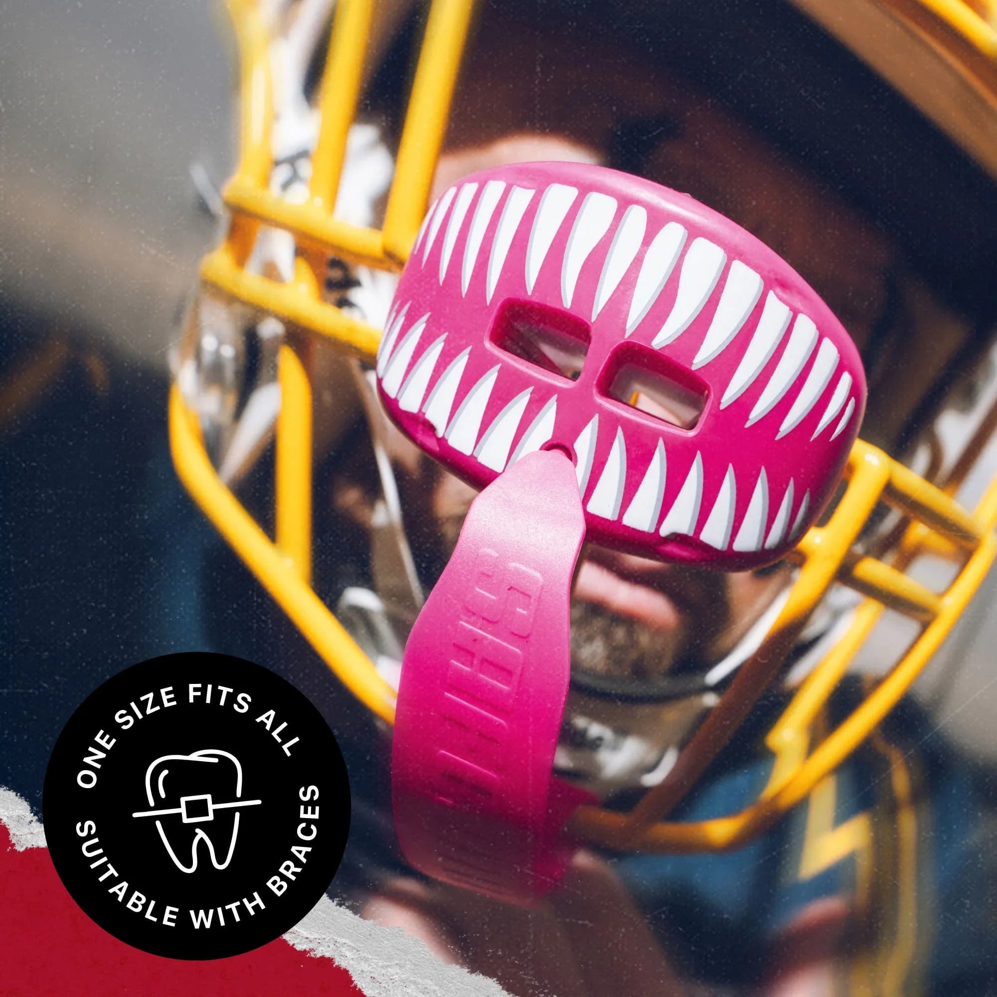 SafeJawz Extro Series leppebeskytter · Viper Pink – alternativt bilde fra SafeJawz